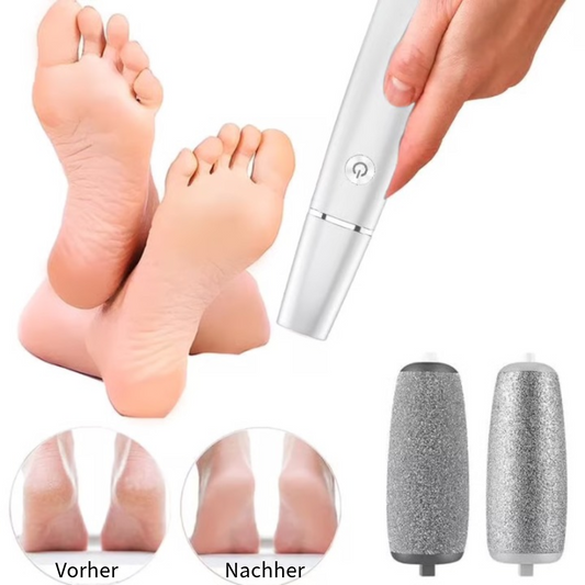 Elektrischer Hornhautentferner
