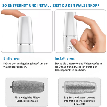 Elektrischer Hornhautentferner