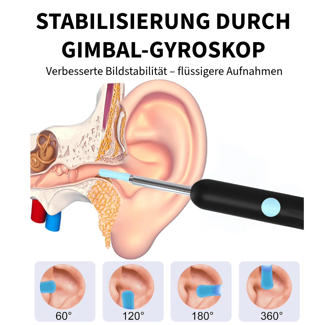 Professioneller Ohrenschmalzentferner mit Kamera