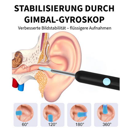 Professioneller Ohrenschmalzentferner mit Kamera