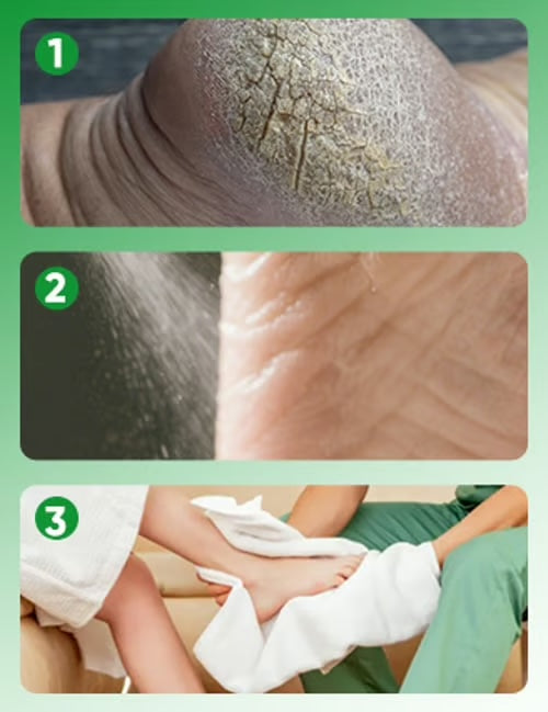 Hornhautentferner Fußspray