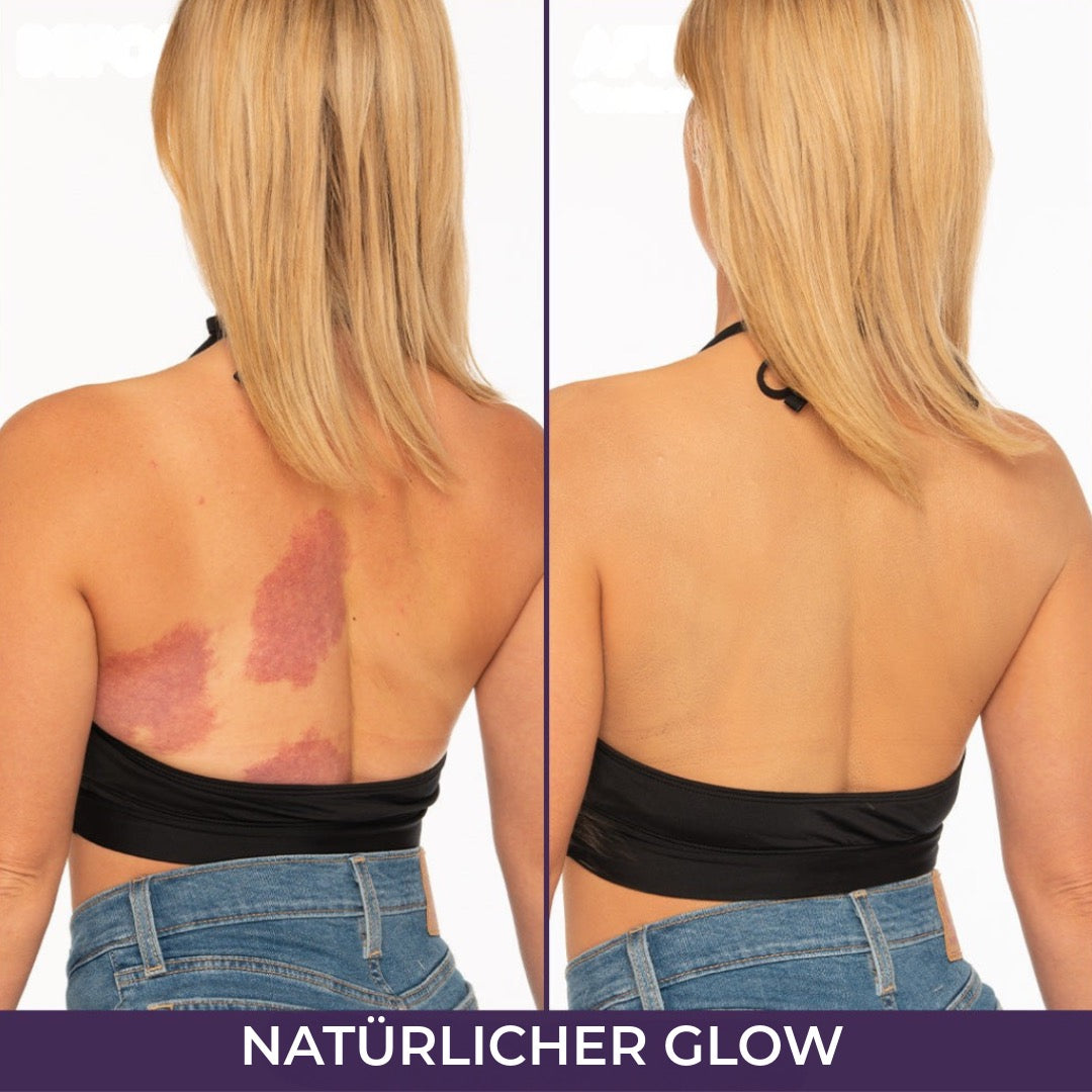 Natürliche Foundation