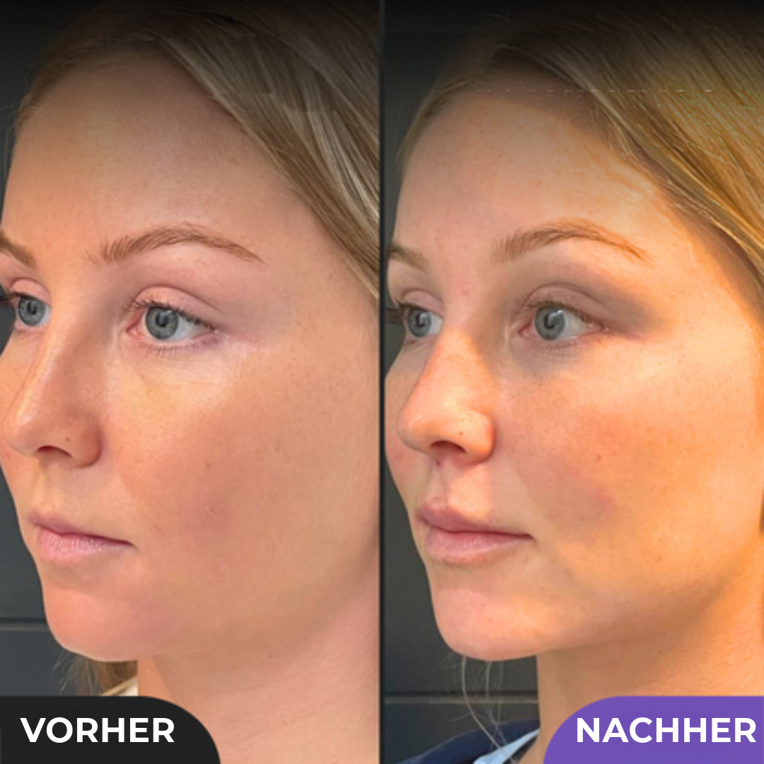 Professioneller Schönheit Shaper