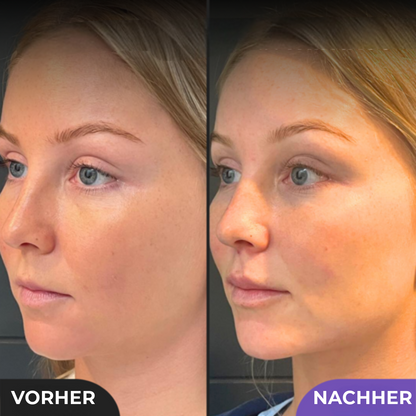 Professioneller Schönheit Shaper